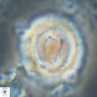 Toweius magnicrassus VR 025658