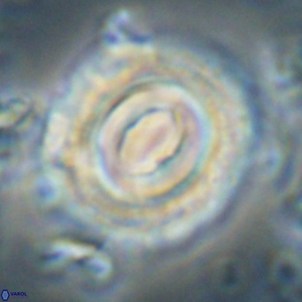 Toweius magnicrassus VR 025659