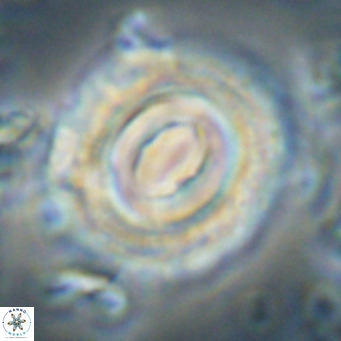 Toweius magnicrassus VR 025659
