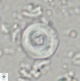 Toweius mikroanaigmus 44633