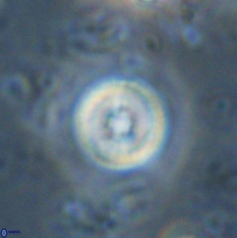 Toweius mikroanaigmus 44635