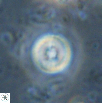 Toweius mikroanaigmus 44635