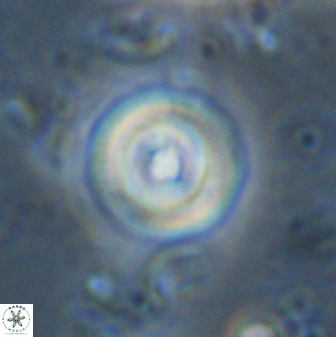 Toweius mikroanaigmus 44636