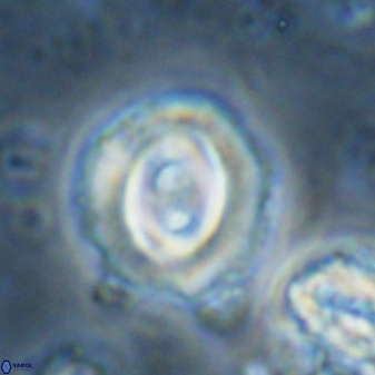 Toweius occultatus 42962