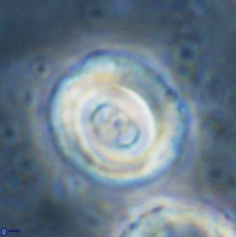Toweius occultatus 43072