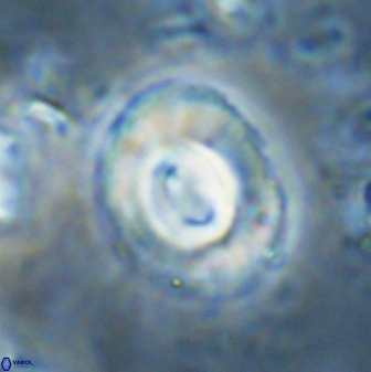 Toweius occultatus 43105