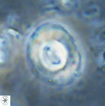 Toweius occultatus 43105