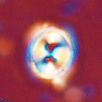 Toweius occultatus 43170