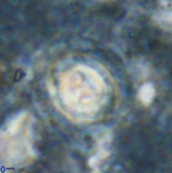 Toweius occultatus 49481
