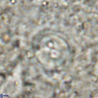 Toweius occultatus 49482