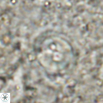 Toweius occultatus 49482