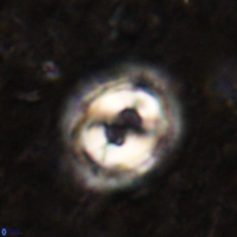 Toweius occultatus 49488
