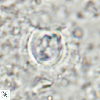 Toweius atalikii 49028