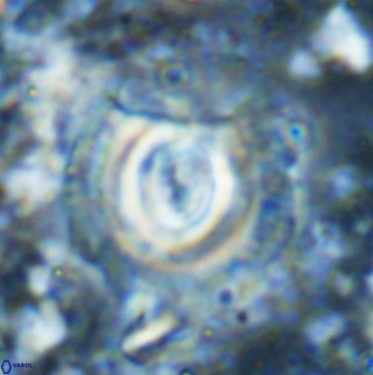 Toweius atalikii 49029