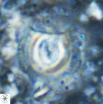 Toweius atalikii 49029