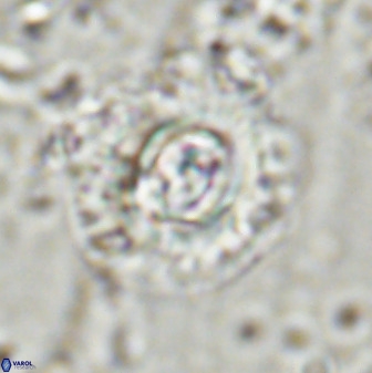 Toweius atalikii 49117