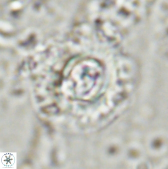 Toweius atalikii 49117