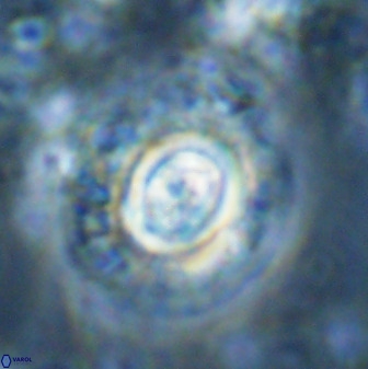 Toweius atalikii 49118