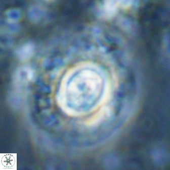Toweius atalikii 49118