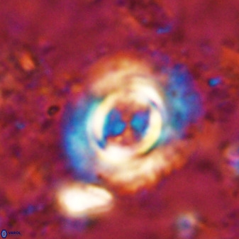 Toweius atalikii 49199