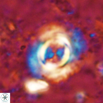 Toweius atalikii 49199