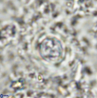 Toweius atalikii 49204