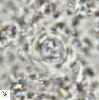 Toweius atalikii 49204
