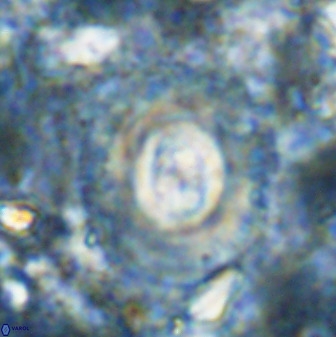 Toweius atalikii 49207