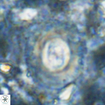 Toweius atalikii 49207