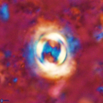 Toweius atalikii 49201