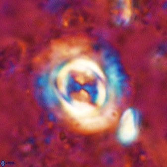 Toweius atalikii 49202