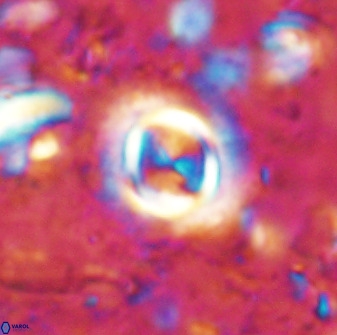 Toweius atalikii 49264