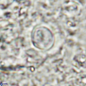 Toweius atalikii 49266