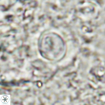 Toweius atalikii 49266