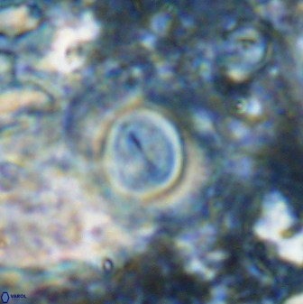 Toweius atalikii 49267