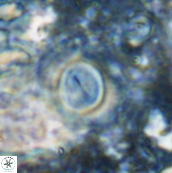 Toweius atalikii 49267