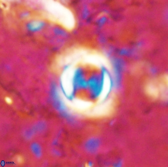 Toweius atalikii 49260