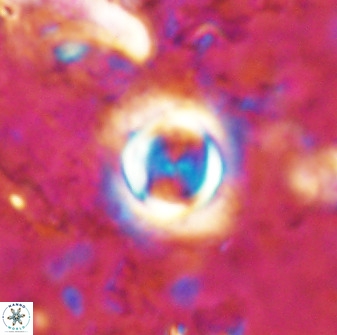 Toweius atalikii 49260