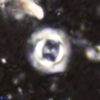 Toweius atalikii 49261