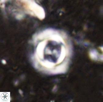 Toweius atalikii 49261