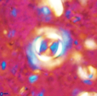 Toweius atalikii 49263