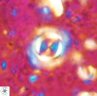 Toweius atalikii 49263
