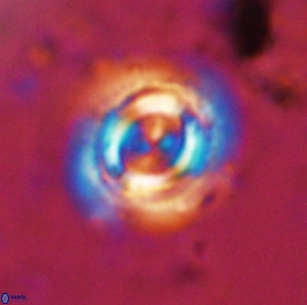 Toweius atalikii 49275