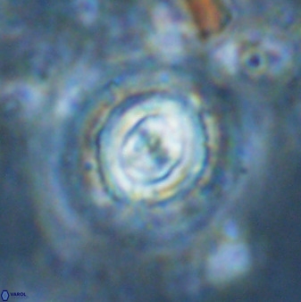 Toweius atalikii 49272