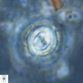 Toweius atalikii 49272