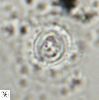 Toweius atalikii 49273