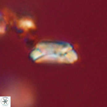 Toweius callosus 20749