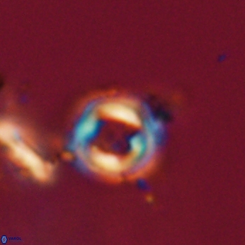 Toweius callosus 20752
