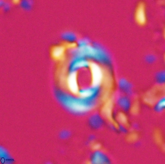 Toweius callosus 22612