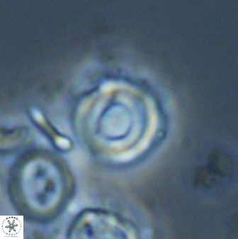 Toweius callosus 22630